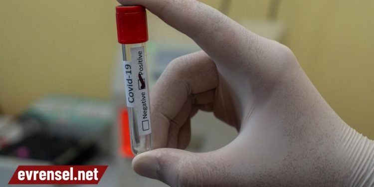 Bazı özel hastaneler fazla ücret alıp koronavirüs test sonuçlarını sisteme girmemiş