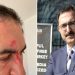 Gazeteci Abdullah Bozkurt’a İsveç’te saldırı