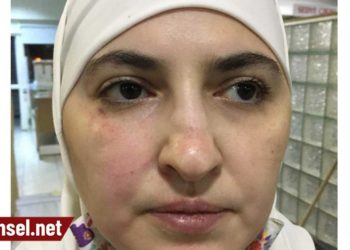 Antep’te mülteci kadınlara hakaret ve darp: Türk değilsin, karşı çıkmaya hakkın yok