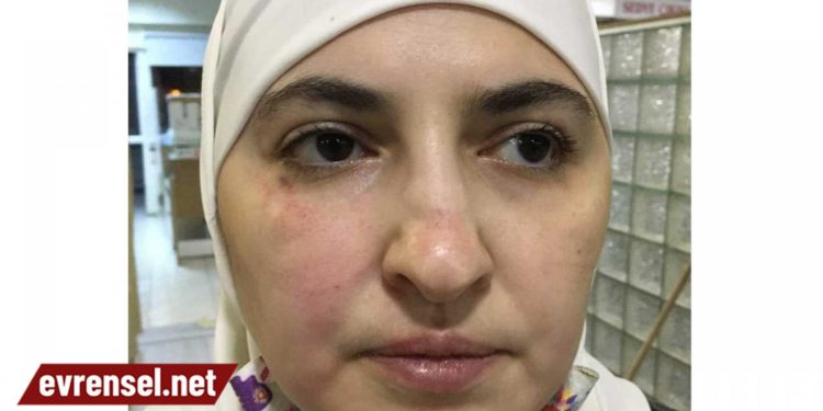 Antep’te mülteci kadınlara hakaret ve darp: Türk değilsin, karşı çıkmaya hakkın yok