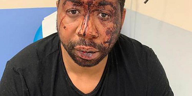 Macron: Polisin dayak görüntüleri Fransa için utanç verici