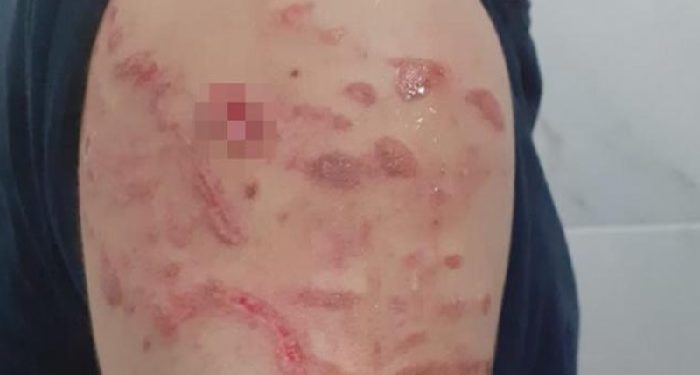 Gözaltına alınanlar işkenceyi anlattı: “Uykudan bağırarak kalkıyorum”