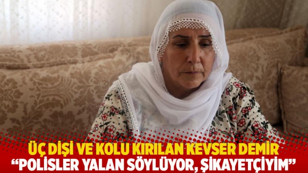 Üç dişi ve kolu kırılan Kevser Demir: Polisler yalan söylüyor, şikayetçiyim