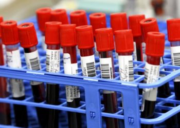 Çocuklarda kan testiyle kemik kanseri teşhisine imkan veren yeni bir ‘sıvı biyopsi’ geliştirildi