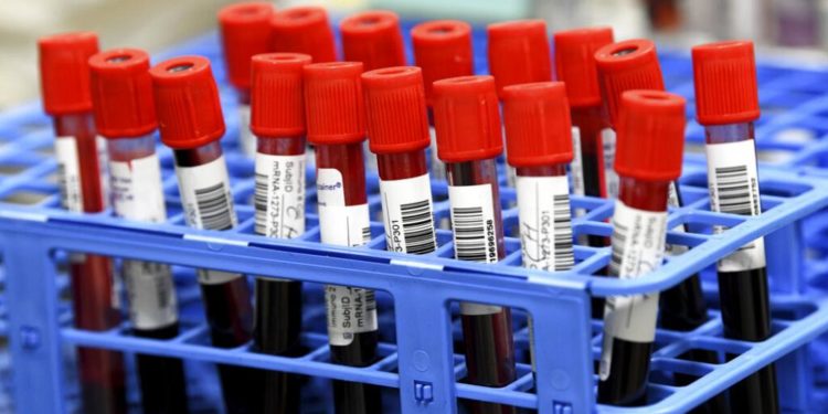 Çocuklarda kan testiyle kemik kanseri teşhisine imkan veren yeni bir ‘sıvı biyopsi’ geliştirildi