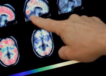 Beyin yiyen amiplerin sayısını artıyor