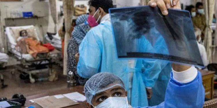 Hindistan’da şimdi de ‘kara mantar’ alarmı: 8 bin 800’ü aşkın vaka kayda geçti