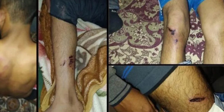 Van’da Afgan mültecilere asker işkencesi