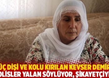 &Uuml;&ccedil; dişi ve kolu kırılan Kevser Demir: Polisler yalan s&ouml;yl&uuml;yor, şikayet&ccedil;iyim