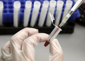 AIDS’e neden olan HIV’e karşı neden hala aşı bulunamadı?