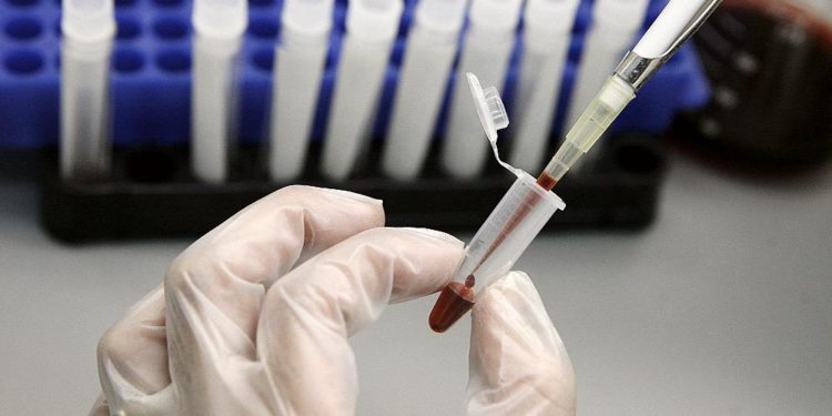 AIDS’e neden olan HIV’e karşı neden hala aşı bulunamadı?