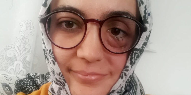 Cezası onandı, ağır hasta kadın tutuklanacak!