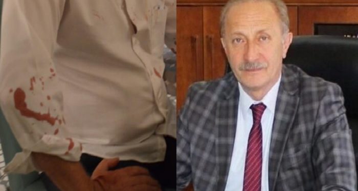 Didim Belediye Başkanı Ahmet Deniz Atabay’a beyzbol sopalı saldırı