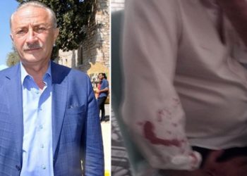 Didim Belediye Başkanı Atabay ve avukatına beyzbol sopalı saldırı