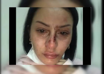 Esenyurt’ta bir kadın, 5 polis tarafından darp edildi