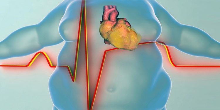 Fazla kilolu insanlarda ölümcül OSAS tehlikesi