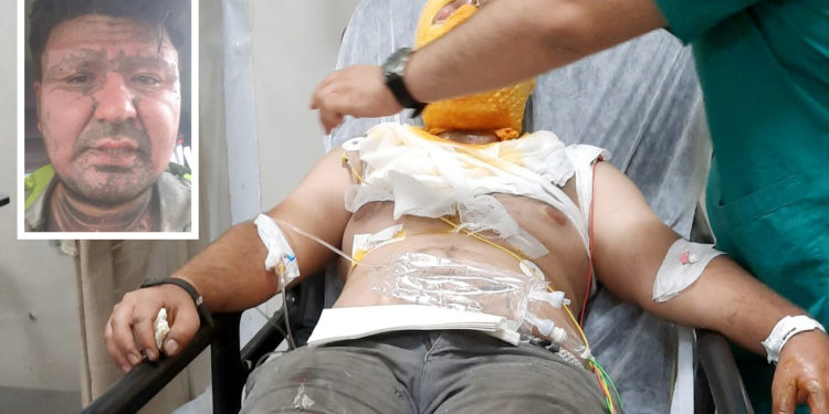 KHK’lı üstteğmen iş kazasında ağır yaralandı, eşi feryat eti: Bizim suçumuz neydi?