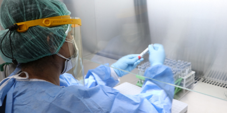 "Koronavirüs testlerinde pozitiflik oranı yüzde 30'dan 10'a düştü"