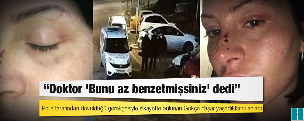 Polis tarafından dövüldüğü gerekçesiyle şikayette bulunan Gökçe Yaşar: "Doktor 'Bunu az benzetmişsiniz' dedi"