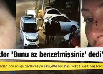 Polis tarafından dövüldüğü gerekçesiyle şikayette bulunan Gökçe Yaşar: "Doktor 'Bunu az benzetmişsiniz' dedi"