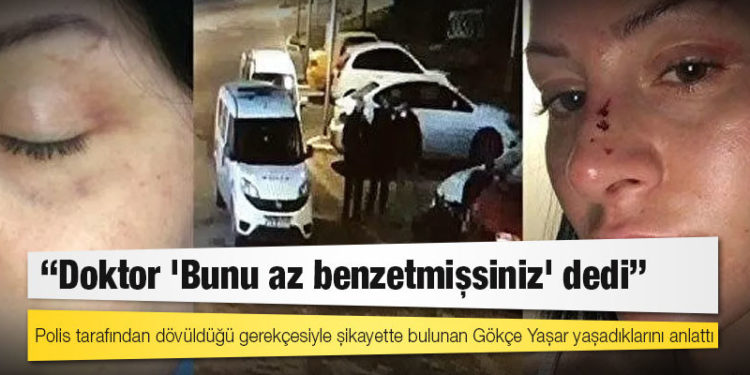 Polis tarafından dövüldüğü gerekçesiyle şikayette bulunan Gökçe Yaşar: "Doktor 'Bunu az benzetmişsiniz' dedi"