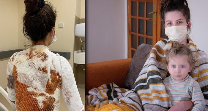 Eşini ve 1.5 yaşındaki kızını yakan adama ‘iyi hal’ indirimi