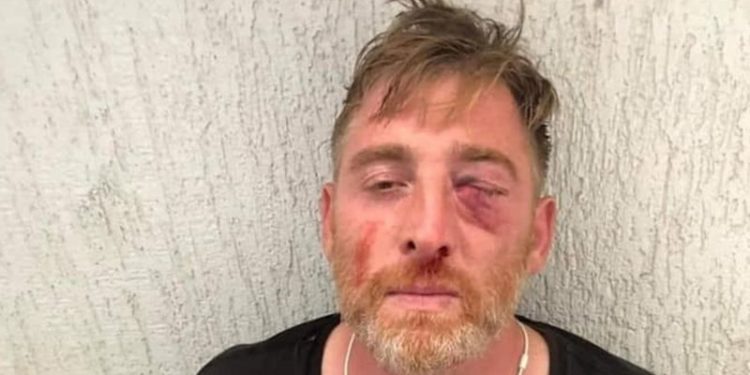 Gürcistan'da LGBTİ+ karşıtlarının yaraladığı kameraman Aleksandr Laşkarava hayatını kaybetti