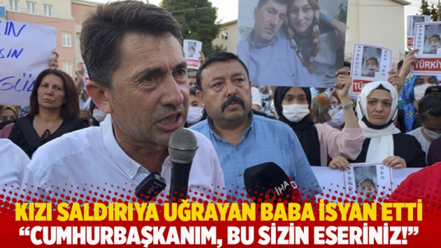 Kızı saldırıya uğrayan baba isyan etti: Cumhurbaşkanım, bu sizin eseriniz!