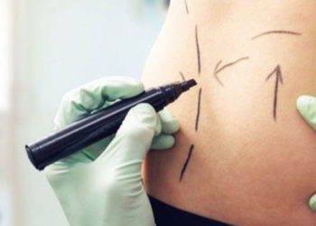 Narko kültürü ve kadınlar: Meksika'nın uyuşturucu başkentinde seks karşılığı estetik ameliyat