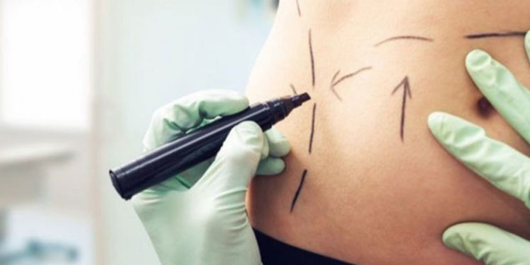 Narko kültürü ve kadınlar: Meksika'nın uyuşturucu başkentinde seks karşılığı estetik ameliyat