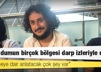 Salih Gergerlioğlu: Vücudumun birçok bölgesi darp izleriyle dolu