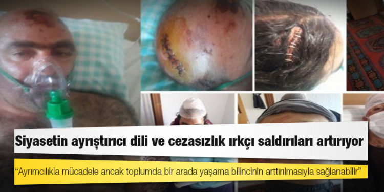 Siyasetin ayrıştırıcı dili ve cezasızlık ırkçı saldırıları artırıyor