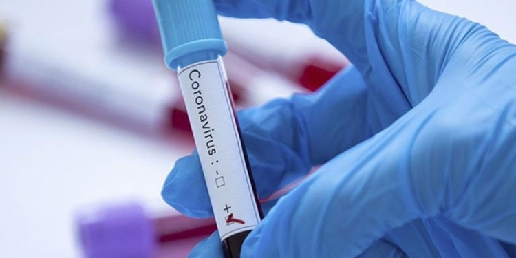 Tokyo Olimpiyatları'na akredite kişilerden Kovid-19'a yakalananların sayısı 155'e çıktı