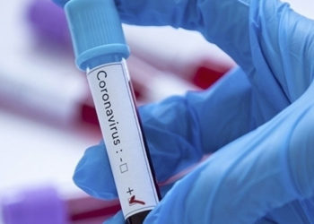 Tokyo Olimpiyatları'na akredite kişilerden Kovid-19'a yakalananların sayısı 169'a çıktı