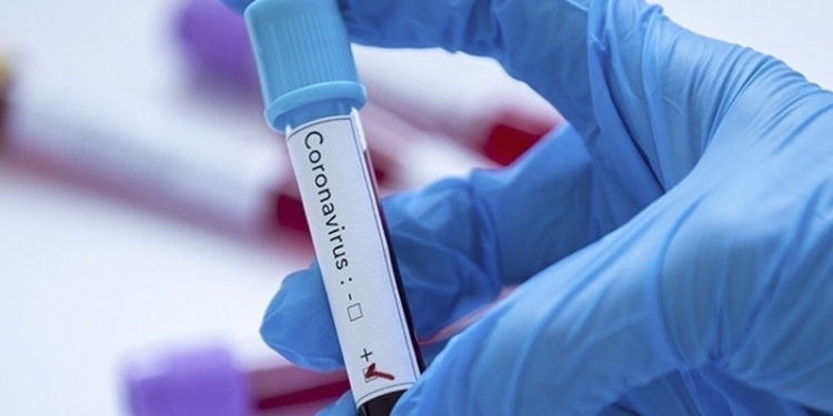 Tokyo Olimpiyatları'na akredite kişilerden Kovid-19'a yakalananların sayısı 169'a çıktı