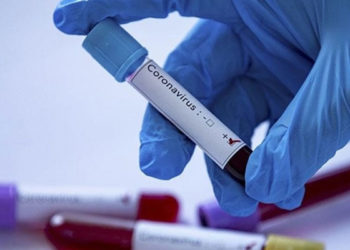 Tokyo Olimpiyatları'na akredite kişilerden Kovid-19'a yakalananların sayısı 193'e çıktı