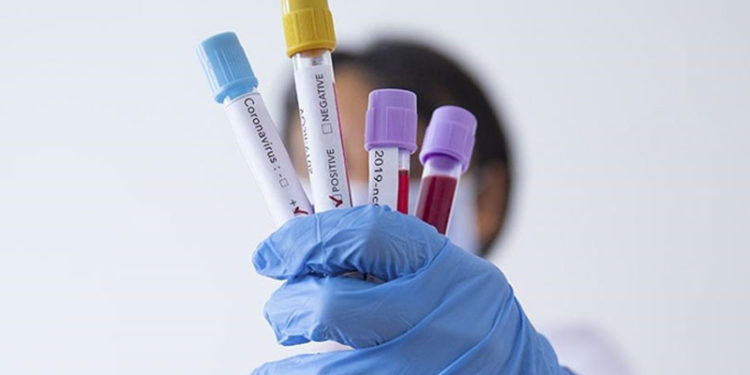 Tokyo Olimpiyatları'na akredite kişilerden Kovid-19'a yakalananların sayısı 241'ye çıktı