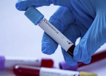 Tokyo Olimpiyatları'na akredite kişilerden Kovid-19'a yakalananların sayısı 79'a çıktı