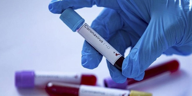 Tokyo Olimpiyatları'na akredite kişilerden Kovid-19'a yakalananların sayısı 79'a çıktı