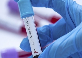 Tokyo Olimpiyatları'na akredite kişilerden Kovid-19'a yakalananların sayısı 87'ye çıktı