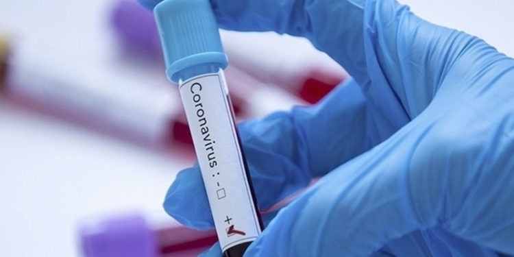 Tokyo Olimpiyatları'na akredite kişilerden Kovid-19'a yakalananların sayısı 87'ye çıktı