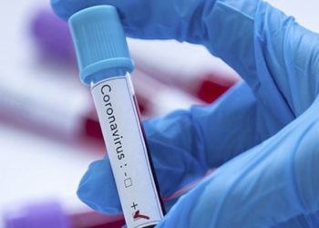 Tokyo'ya gelen olimpiyat sporcularında ilk pozitif Kovid-19 vakası