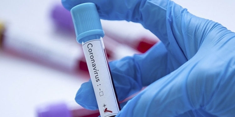 Tokyo'ya gelen olimpiyat sporcularında ilk pozitif Kovid-19 vakası