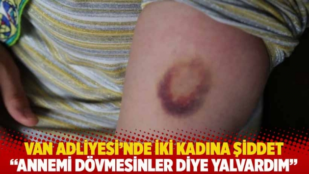 Van Adliyesi’nde iki kadına şiddet: Annemi dövmesinler diye yalvardım