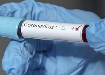 2020 Olimpiyatları'nda ilk Kovid-19 küme vakası saptandı