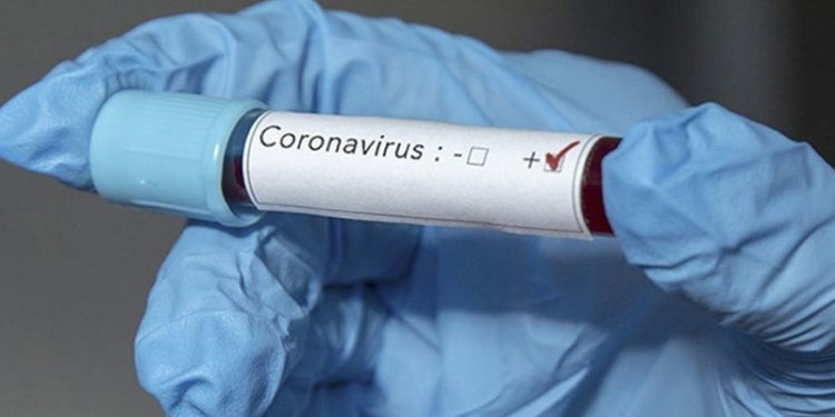 2020 Olimpiyatları'nda ilk Kovid-19 küme vakası saptandı