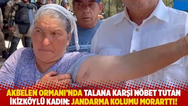 Akbelen Ormanı'nda nöbet tutan İkizköylü kadın: Jandarma kolumu morarttı