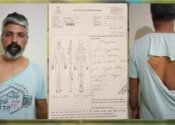 Antalya’da ırkçı saldırı: Yol kesip Kürt vatandaşı darp ettiler