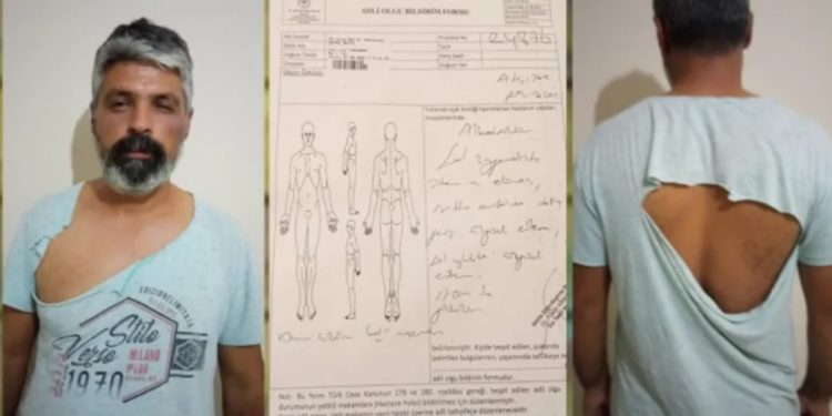 Antalya’da ırkçı saldırı: Yol kesip Kürt vatandaşı darp ettiler