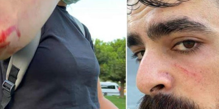 HDP’li gençlere ırkçı saldırı: Gazeteciler de yaralandı